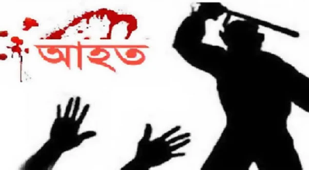 deshchitro-63037856e768f-220822063638.webp