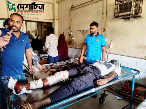 deshchitro-69ad5a0562f6a-080326051413.webp